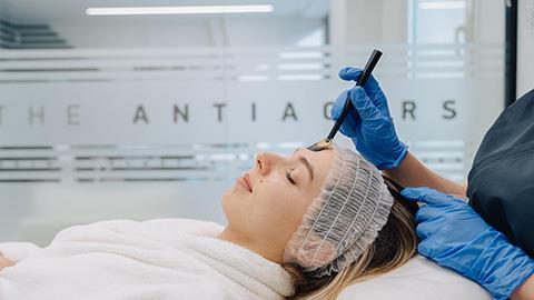 Nanopeeling: Πίλινγκ Προσώπου με Στοχευμένη Δράση