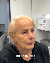 Signature Antigravity Lift™