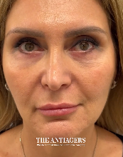 Signature Antigravity Lift™