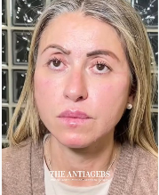 Signature Antigravity Lift™