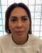 Signature Antigravity Lift™