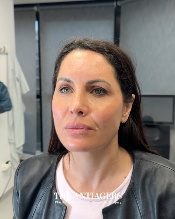 Signature Antigravity Lift™