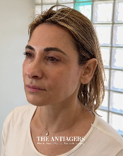 Signature Antigravity Lift™