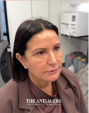 Signature Antigravity Lift™