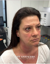 Signature Antigravity Lift™