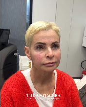 Signature Antigravity Lift™