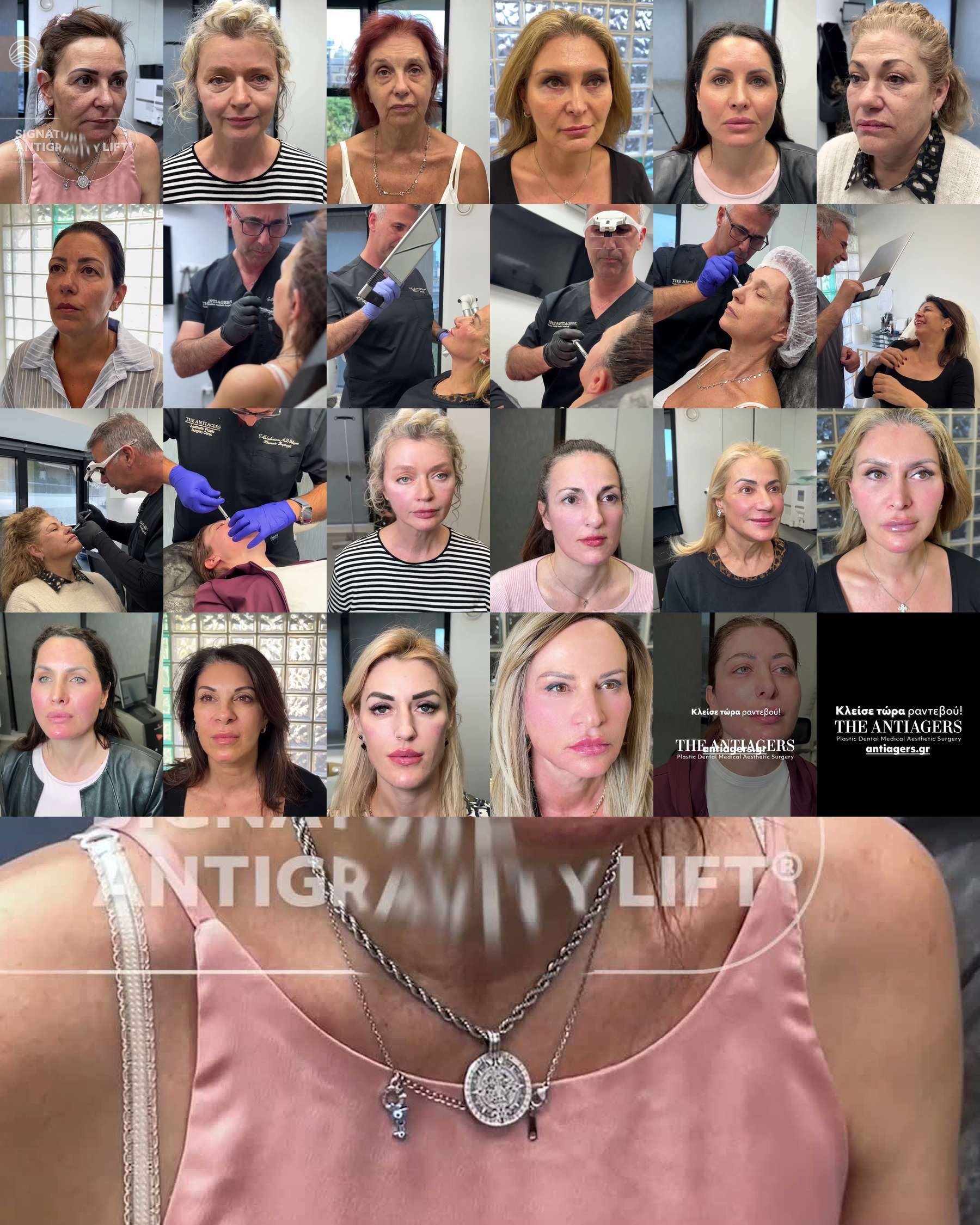 Signature Antigravity Lift®