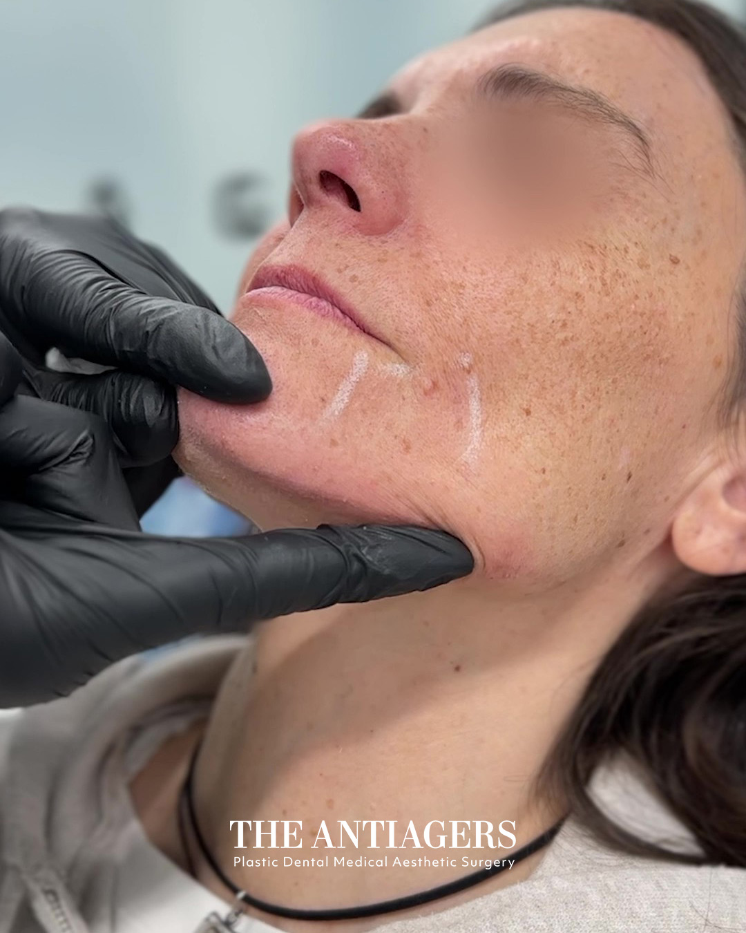 TV Antiagers