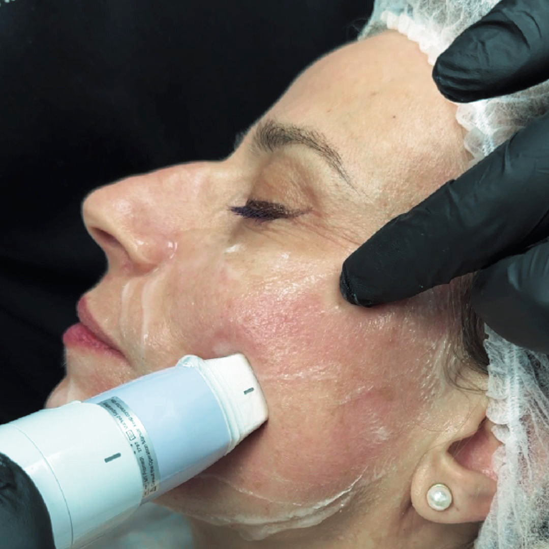 Γιατί να επιλέξετε το Volnewmer;